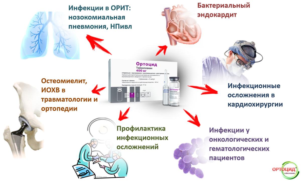 ПАО «КРАСФАРМА» ЗАРЕГИСТРИРОВАЛА НОВЫЕ РЕЖИМЫ ДОЗИРОВАНИЯ ТЕЙКОПЛАНИНА
